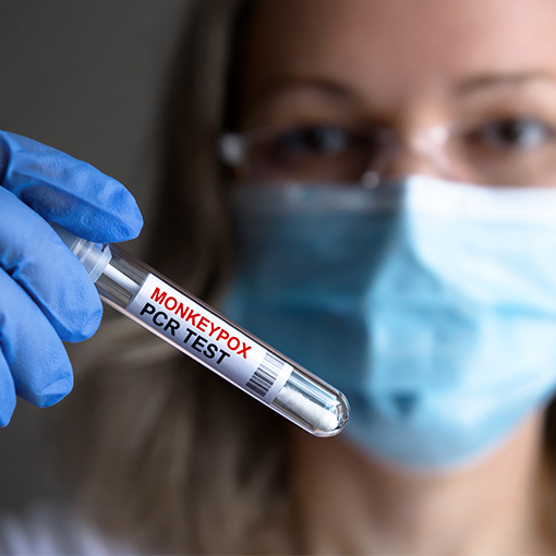 超聲波混勻技術在體外診斷領域中應用